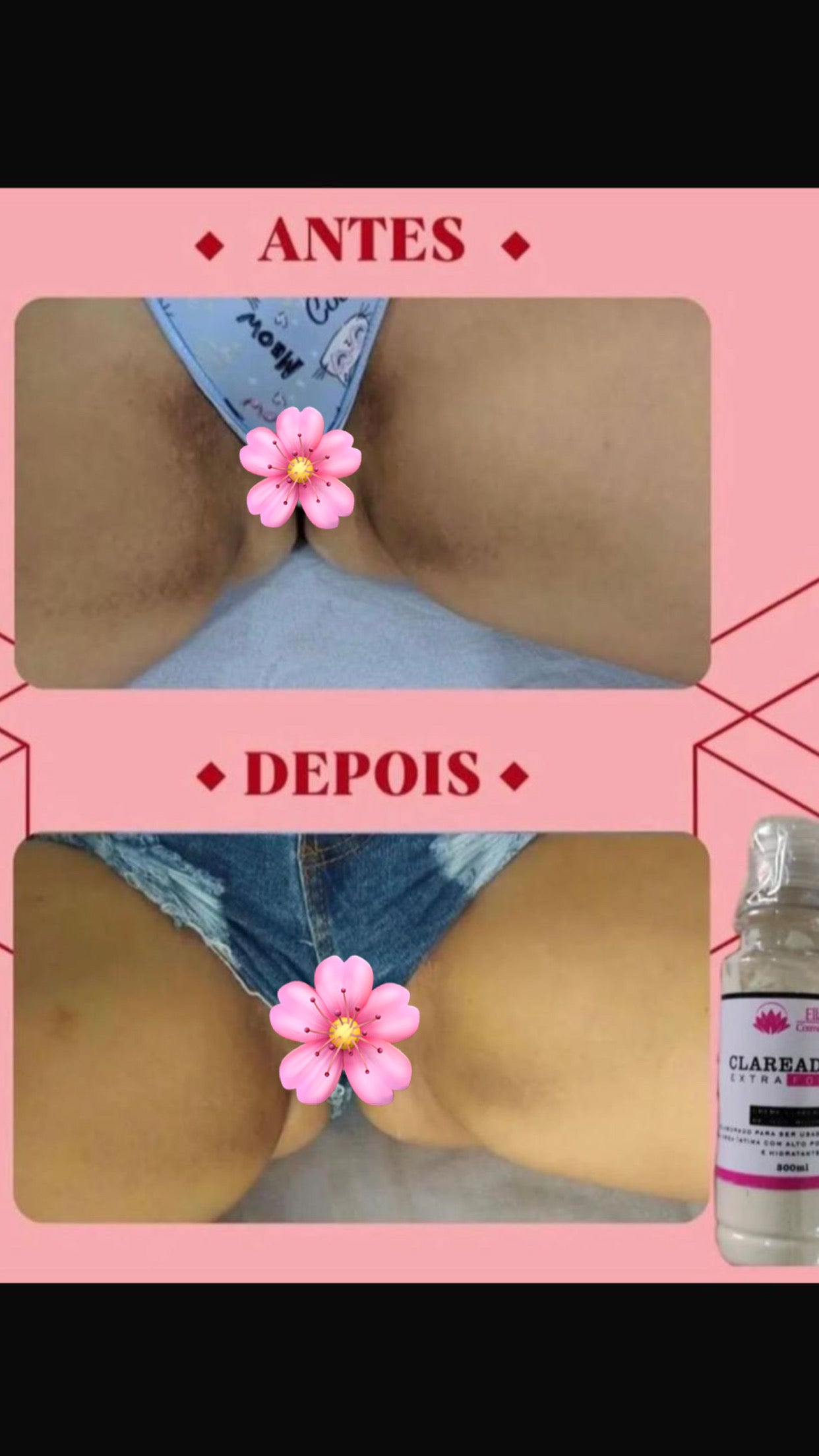 CRÈME ÉCLAIRCISSANTE (Zone intime)